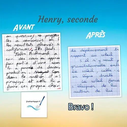 Avant-après de l’écriture d’un élève de seconde après des séances de graphopédagogie.
