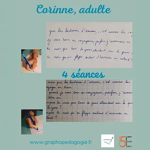 Avant et après de l’écriture d’une adulte après quatre séances de graphopédagogie.